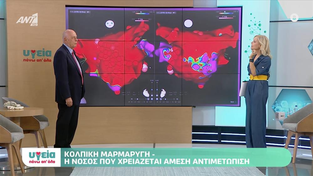 Κολπική μαρμαρυγή και σωστή αντιμέτωπισή - Επεισόδιο 75 - 11ος ΚΥΚΛΟΣ