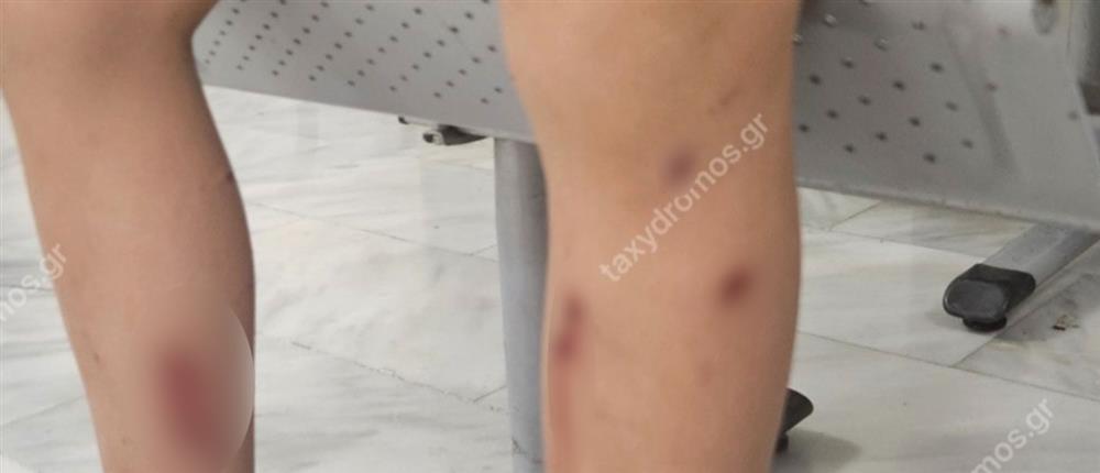 Βόλος - 7χρονος - Αδέσποτα