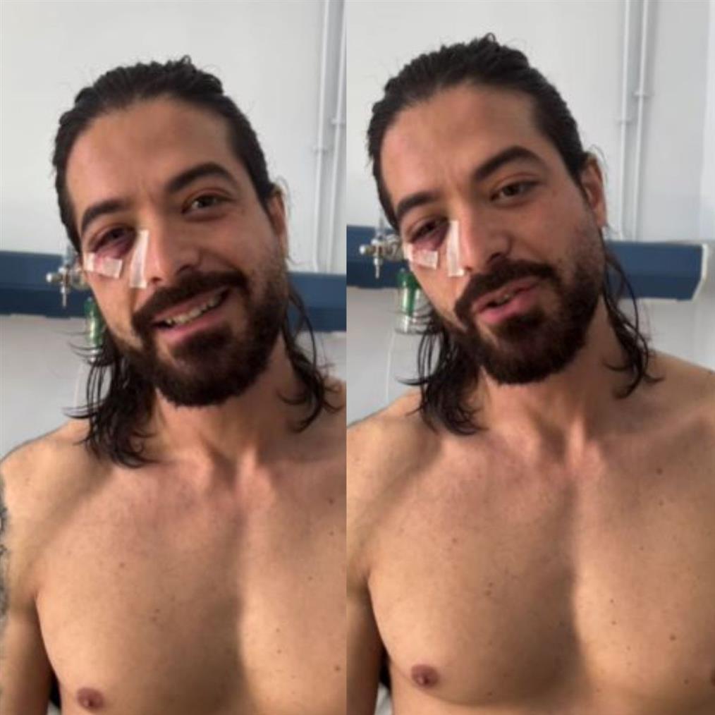 Άρης Μουγκοπέτρος